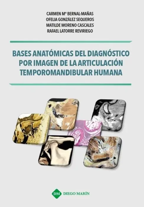 Bases anatomicas del diagnostico por imagen de la articulacion temporomandibular humana