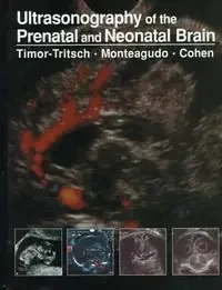 Ultrasonography prenatal neonatal brai – Blau Press